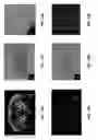 Fig. 25 - MRI imaging of amyloid plaque using liposomes