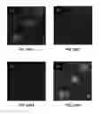 Fig. 26 - MRI imaging of amyloid plaque using liposomes