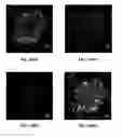 Fig. 27 - MRI imaging of amyloid plaque using liposomes
