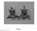 Fig. 05 - METHOD FOR RESTORING A DAMAGED OR DEGENERATED INTERVERTEBRAL DISC