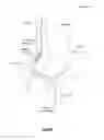 Fig. 02 - Copolymer membrane for high-dose chemotherapy delivery during transarterial chemoembolization