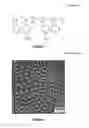 Fig. 04 - Copolymer membrane for high-dose chemotherapy delivery during transarterial chemoembolization