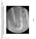 Fig. 09 - Coatings containing multiple drugs