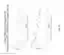 Fig. 16 - Coatings containing multiple drugs