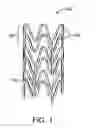 Fig. 02 - Method of treating with poly(L-lactide) stent with tunable degradation rate