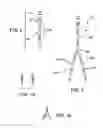 Fig. 03 - METHOD AND SYSTEM PROVIDING MORE ACCURATE FLUID TEMPERATURE MONITORING WITH SELECTABLE FLUID INPUT AND OUTPUT ARRAGEMENTS FOR BODY CAVITY TREATMENTS