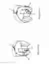 Fig. 14 - SUPPLEMENTAL DEVICE FOR ATTACHMENT TO AN INJECTION DEVICE