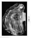 Fig. 22 - Medical unit dose container