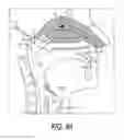 Fig. 34 - Nasal delivery devices