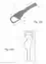 Fig. 12 - Bag/valve/mask resuscitator stabilizer arm and method of use