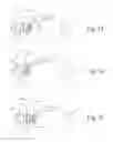 Fig. 13 - Bag/valve/mask resuscitator stabilizer arm and method of use