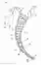 Fig. 01 - PROTECTIVE ENDOTRACHEAL TUBE