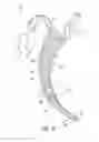 Fig. 03 - PROTECTIVE ENDOTRACHEAL TUBE