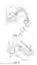 Fig. 02 - Laryngeal mask
