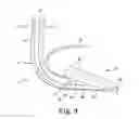 Fig. 08 - Laryngeal mask