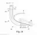 Fig. 09 - Laryngeal mask