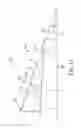 Fig. 10 - Laryngeal mask