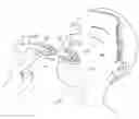 Fig. 01 - Novel airway tube stabilizer