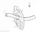 Fig. 02 - Novel airway tube stabilizer