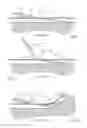 Fig. 03 - CUTANEOUS CATHETER ANCHORING DEVICE AND METHOD OF STABILIZING A CATHETER SITE