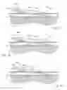 Fig. 10 - CUTANEOUS CATHETER ANCHORING DEVICE AND METHOD OF STABILIZING A CATHETER SITE