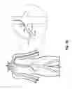 Fig. 05 - Anchoring Device and Methods for Use