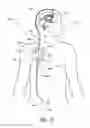 Fig. 02 - DRAINAGE SYSTEMS FOR EXCESS BODY FLUIDS AND ASSOCIATED METHODS