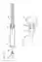 Fig. 17 - Methods and apparatus for disinfecting and reflux prevention flush syringe assembly