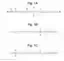 Fig. 02 - Apparatus and methods for assisted breathing by transvascular nerve stimulation