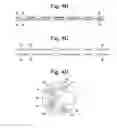 Fig. 05 - Apparatus and methods for assisted breathing by transvascular nerve stimulation
