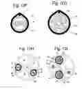 Fig. 14 - Apparatus and methods for assisted breathing by transvascular nerve stimulation