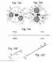 Fig. 15 - Apparatus and methods for assisted breathing by transvascular nerve stimulation