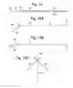 Fig. 18 - Apparatus and methods for assisted breathing by transvascular nerve stimulation