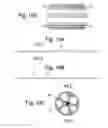 Fig. 22 - Apparatus and methods for assisted breathing by transvascular nerve stimulation