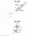 Fig. 27 - Apparatus and methods for assisted breathing by transvascular nerve stimulation