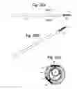 Fig. 28 - Apparatus and methods for assisted breathing by transvascular nerve stimulation