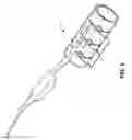 Fig. 03 - Methods of treatment of a neurological disorder using electrical nerve conduction block