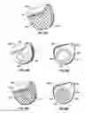 Fig. 09 - APPARATUS AND METHODS FOR CHARGING AN IMPLANTED MEDICAL DEVICE POWER SOURCE
