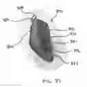 Fig. 36 - Sports Performance Enhancement System