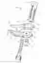 Fig. 01 - Jaw exerciser