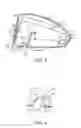 Fig. 03 - Golf club head with flexure