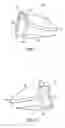 Fig. 05 - Golf club head with flexure