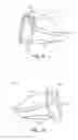 Fig. 06 - Golf club head with flexure