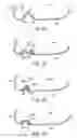 Fig. 17 - Golf club head with flexure