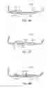 Fig. 23 - Golf club head with flexure