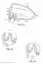 Fig. 25 - Golf club head with flexure