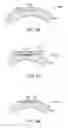 Fig. 32 - Golf club head with flexure