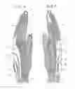 Fig. 05 - Glove for conforming to hands of various sizes