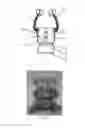 Fig. 04 - Squeezable face-covering toy and its squeeze mechanism
