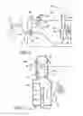 Fig. 02 - Method and apparatus for inflating a balloon